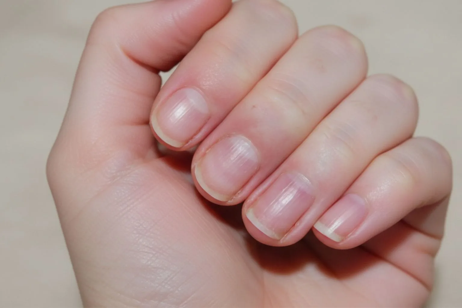 Ребристі нігті на руках